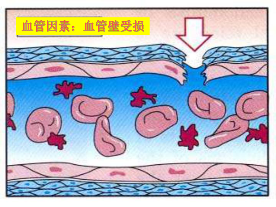 凝血项目在妇产科应用课件.ppt_第3页