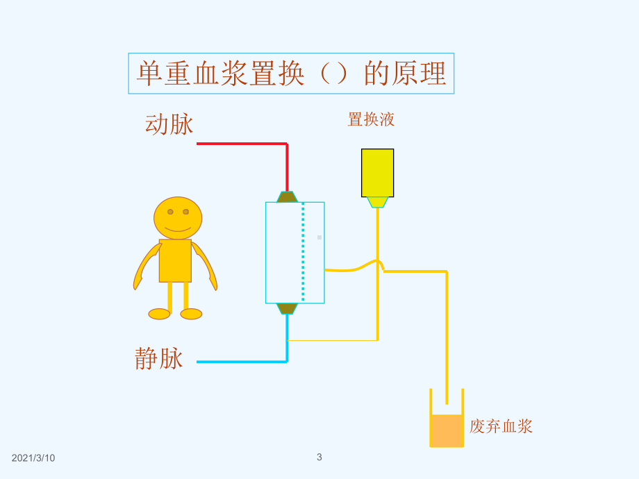 免疫吸附法在风湿免疫中的应用课件.pptx_第3页