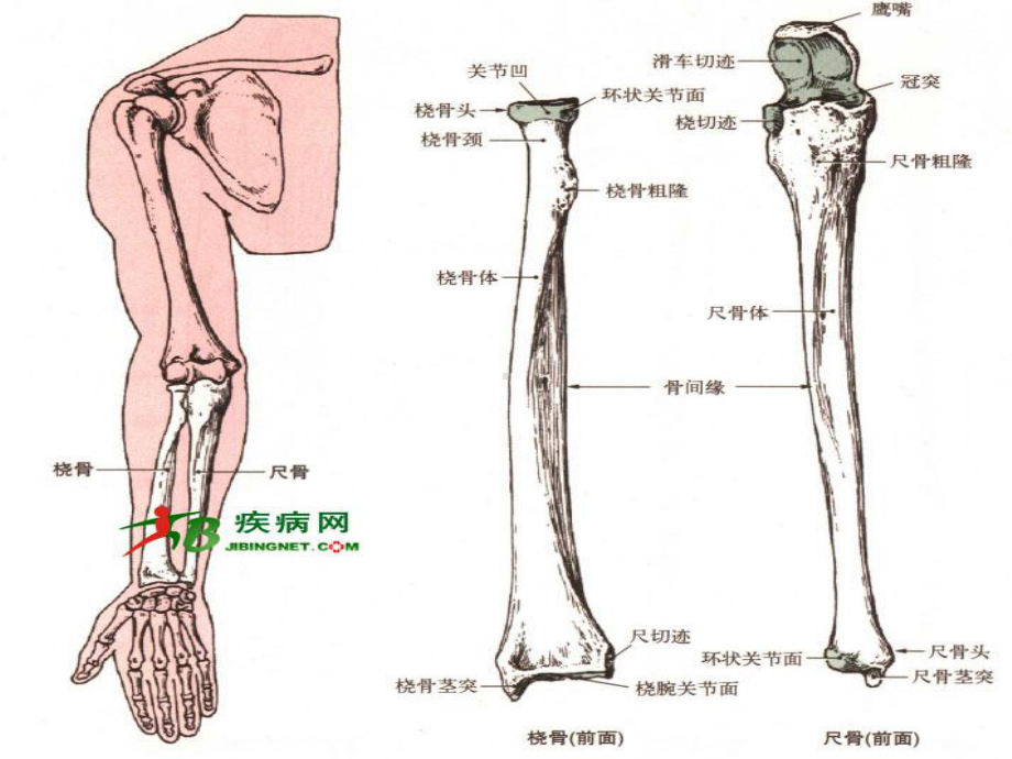 九月份尺桡骨骨折护理课件.ppt_第2页