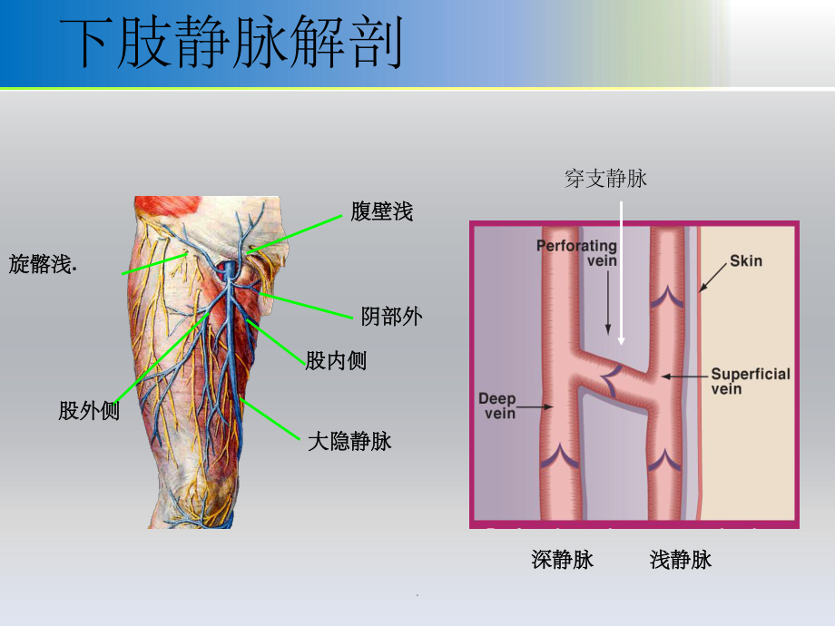 大隐静脉曲张剥脱术课件.ppt_第3页