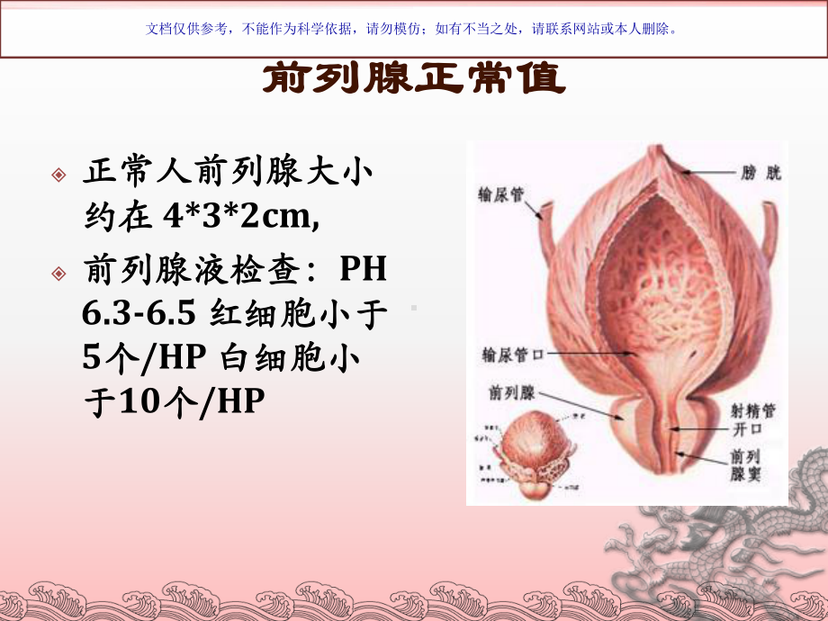 前列腺增生医疗护理专题宣讲课件.ppt_第3页