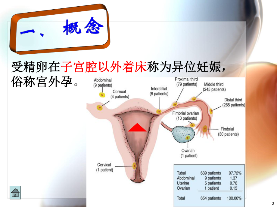 宫外孕并茂-课件.ppt_第2页