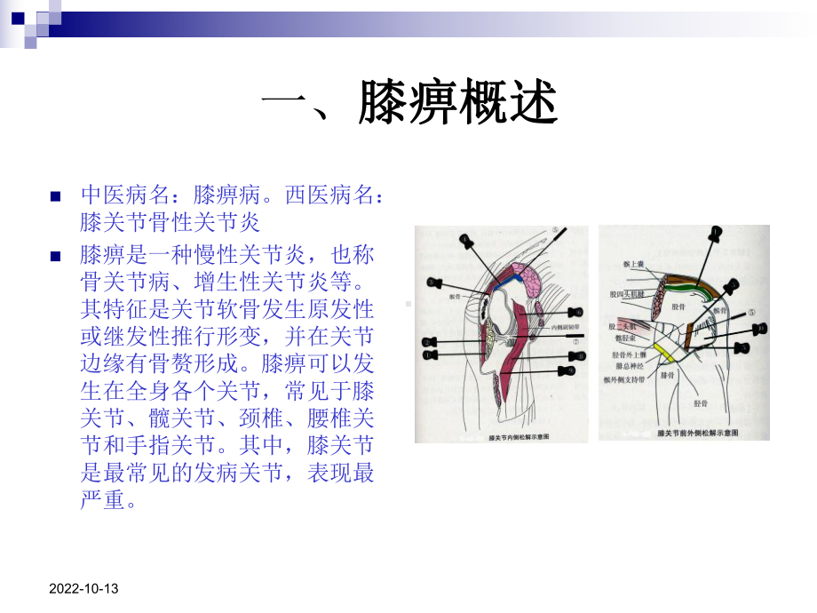 医学课件膝关节炎中医医疗护理专题宣讲.ppt_第2页