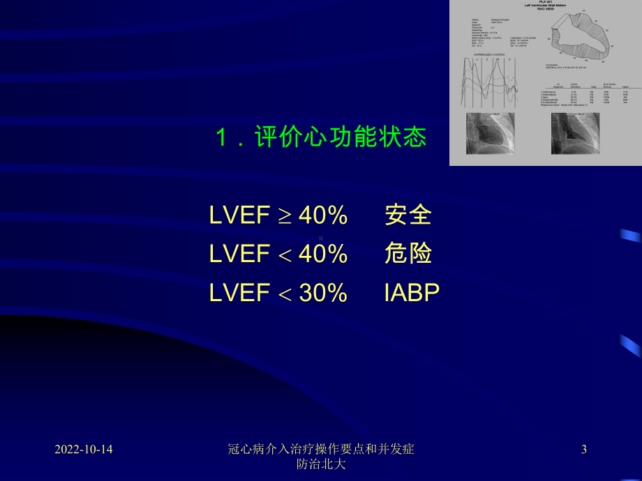 冠心病介入治疗操作要点和并发症防治北大课件.ppt_第3页