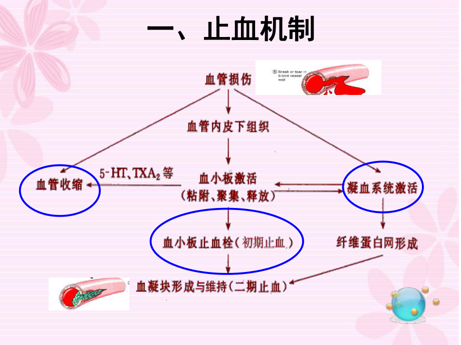 医学特发性血小板减少性紫癜培训课件.ppt_第3页