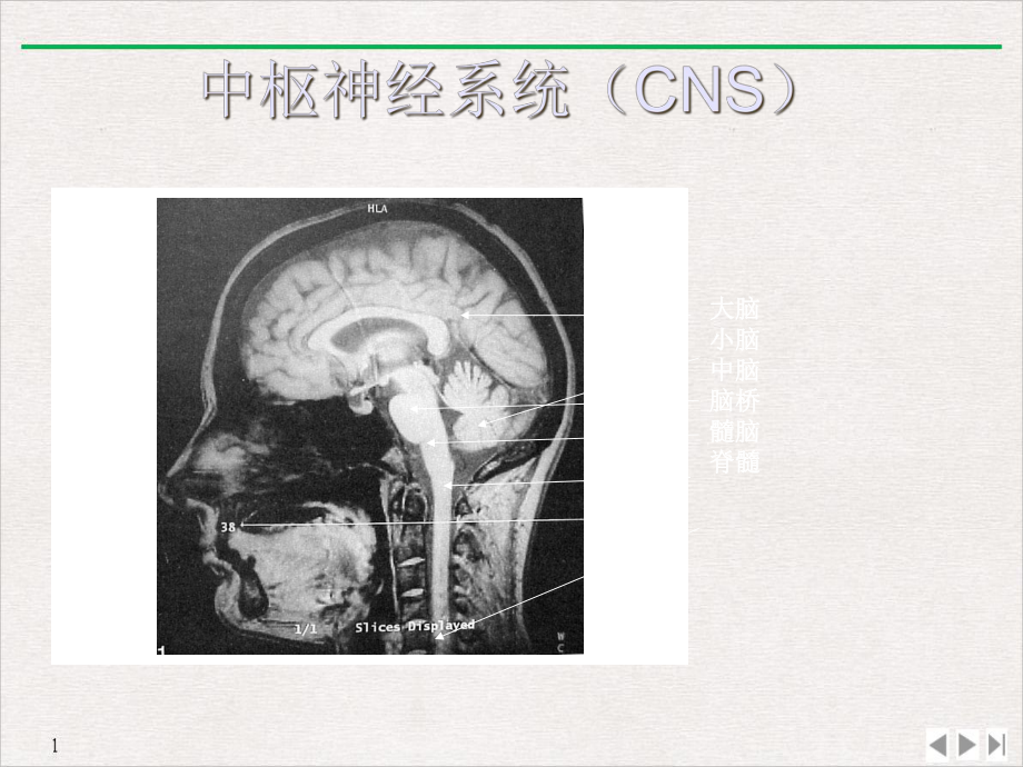 大脑血管解剖经颅超声课件.ppt_第2页