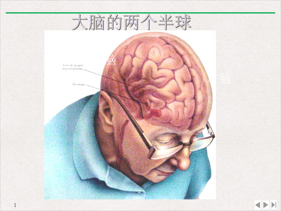 大脑血管解剖经颅超声课件.ppt_第3页