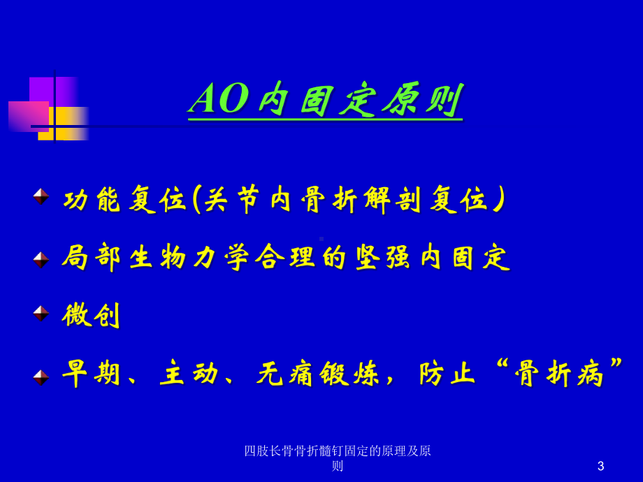 四肢长骨骨折髓钉固定的原理及原则课件.ppt_第3页