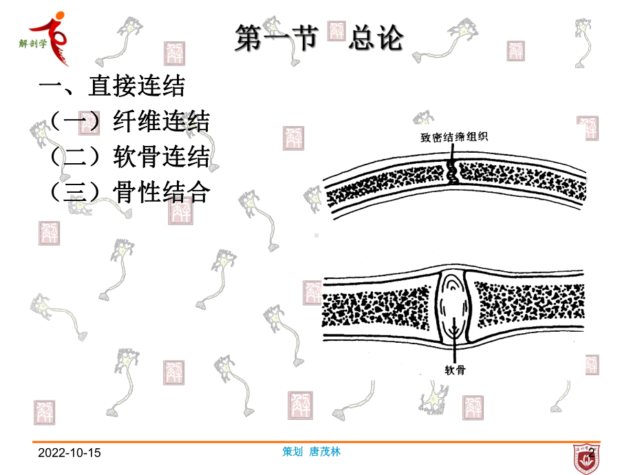 关节学医学知识讲座课件.ppt_第2页