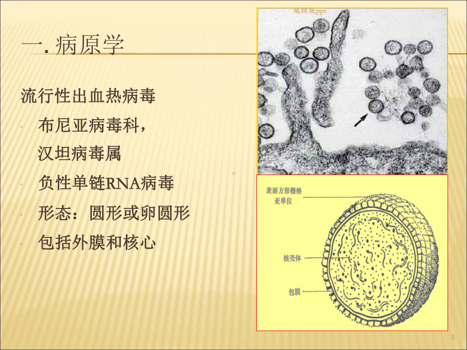 内科流行性出血热课件.ppt_第3页