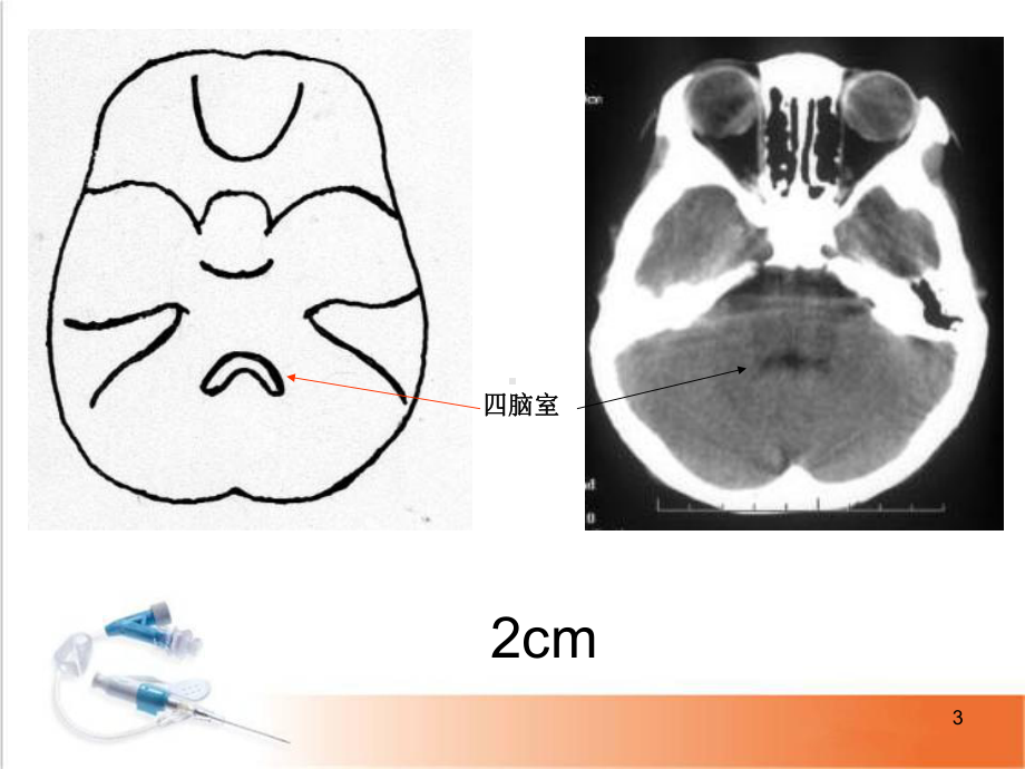 医学课件-头颅CT影像解剖课件.ppt_第3页