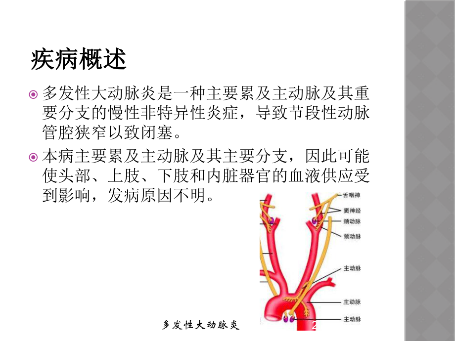 多发性大动脉炎培训课件.ppt_第2页