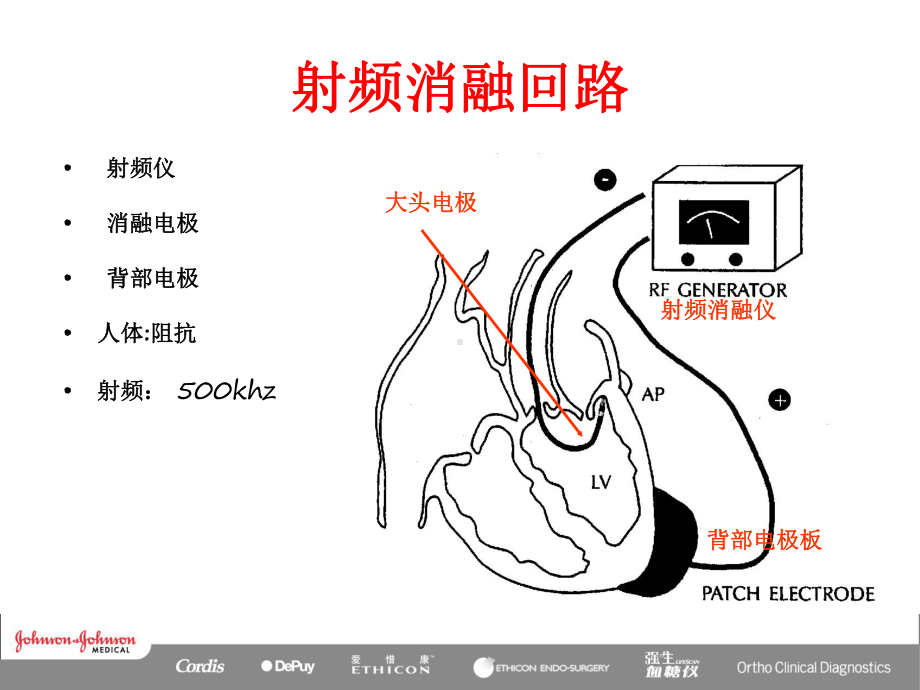 医学射频消融原理培训课件.ppt_第3页