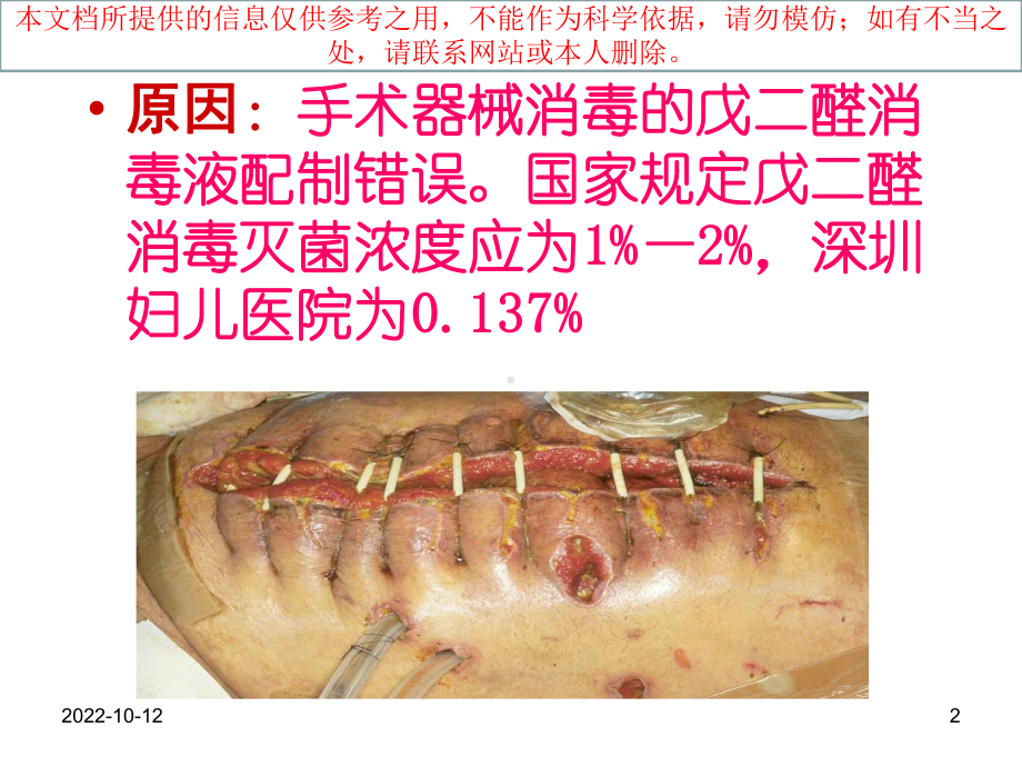 历次重大医院感染事件回顾培训课件.ppt_第2页