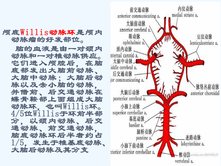 动脉瘤病人护理查房课件.ppt_第3页