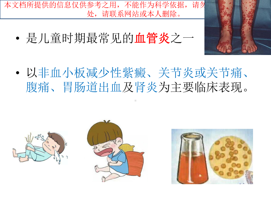 二零一八过敏性紫癜培训课件.ppt_第1页