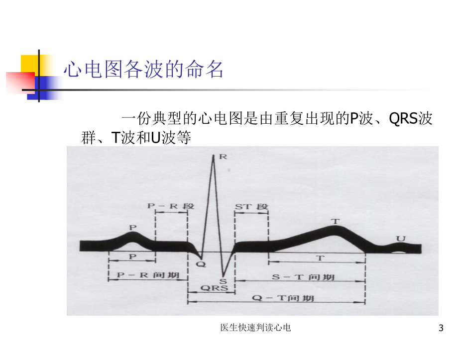 医生快速判读心电课件.ppt_第3页