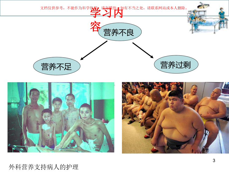 外科营养支持病人的护理培训课件.ppt_第3页