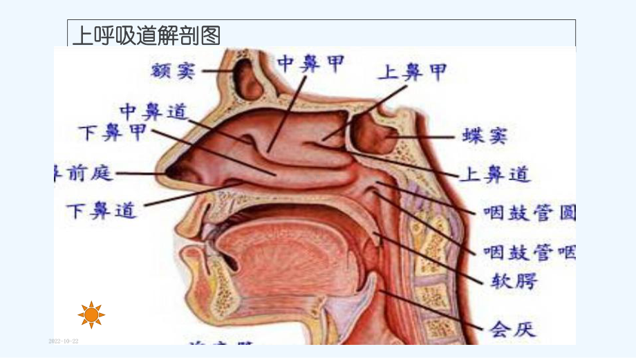 小儿上呼吸道感染课件.ppt_第3页