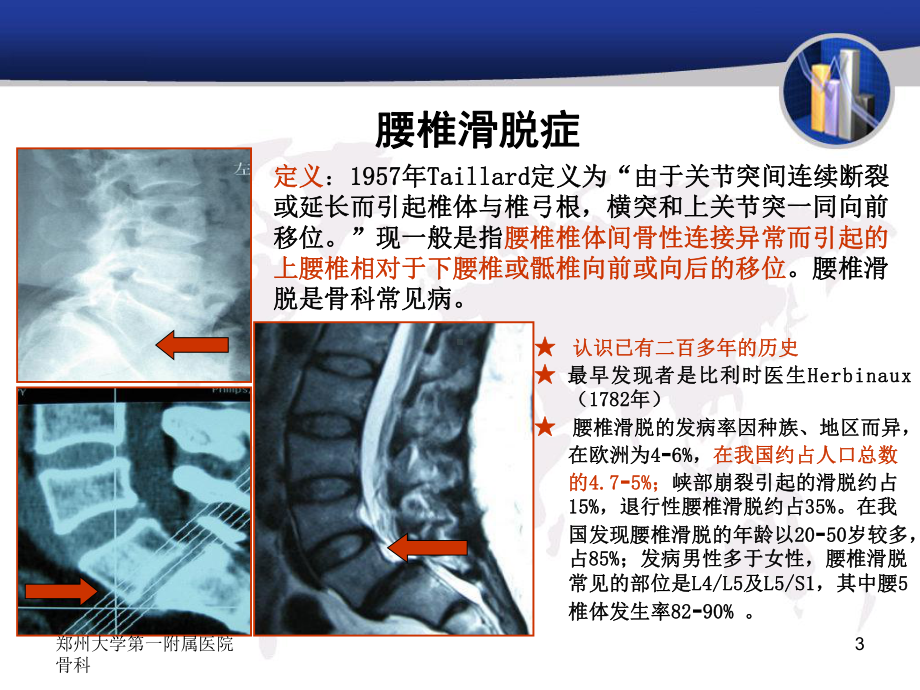 医学皮国富腰椎滑脱症的诊疗体会培训课件.ppt_第3页