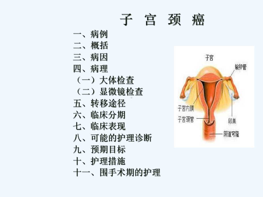 子宫颈癌的护理查房课件.ppt_第2页