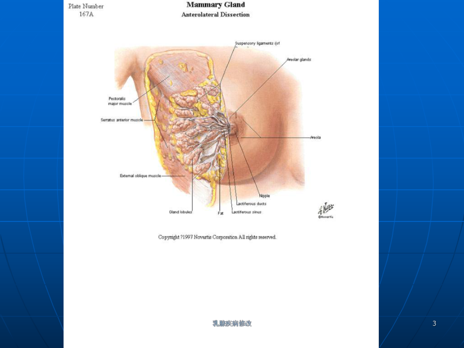 乳腺疾病修改课件.ppt_第3页