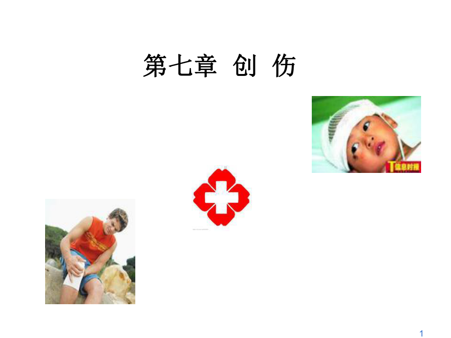 创伤精选课件.ppt_第1页