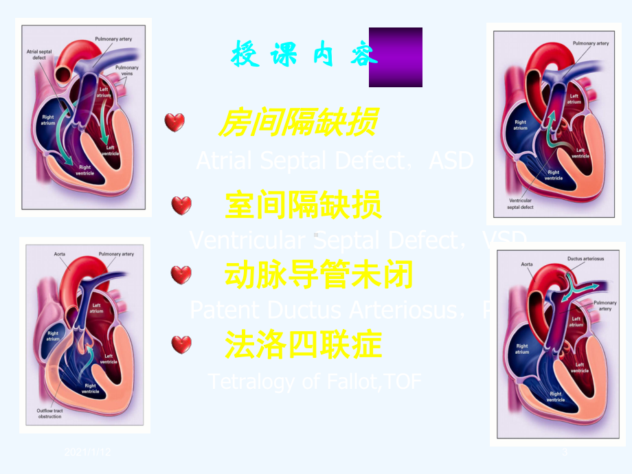 先天性心脏病血液动力学改变课件.ppt_第3页