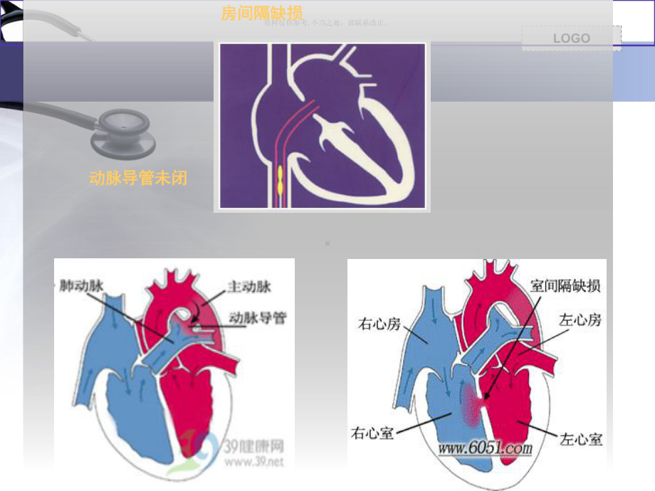 先心病人的护理课件.ppt_第2页