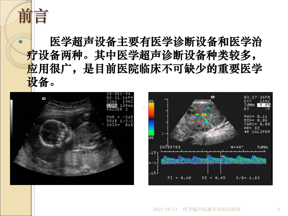 医学超声仪器专业知识培训培训课件.ppt_第3页