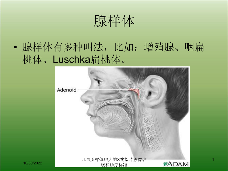 儿童腺样体肥大的X线摄片影像表现和诊疗标准课件.ppt_第1页