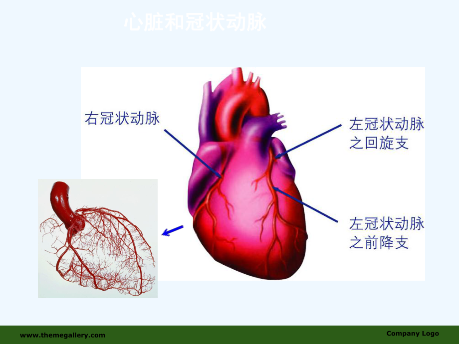 冠心病的诊断与治疗权威之作课件.ppt_第2页