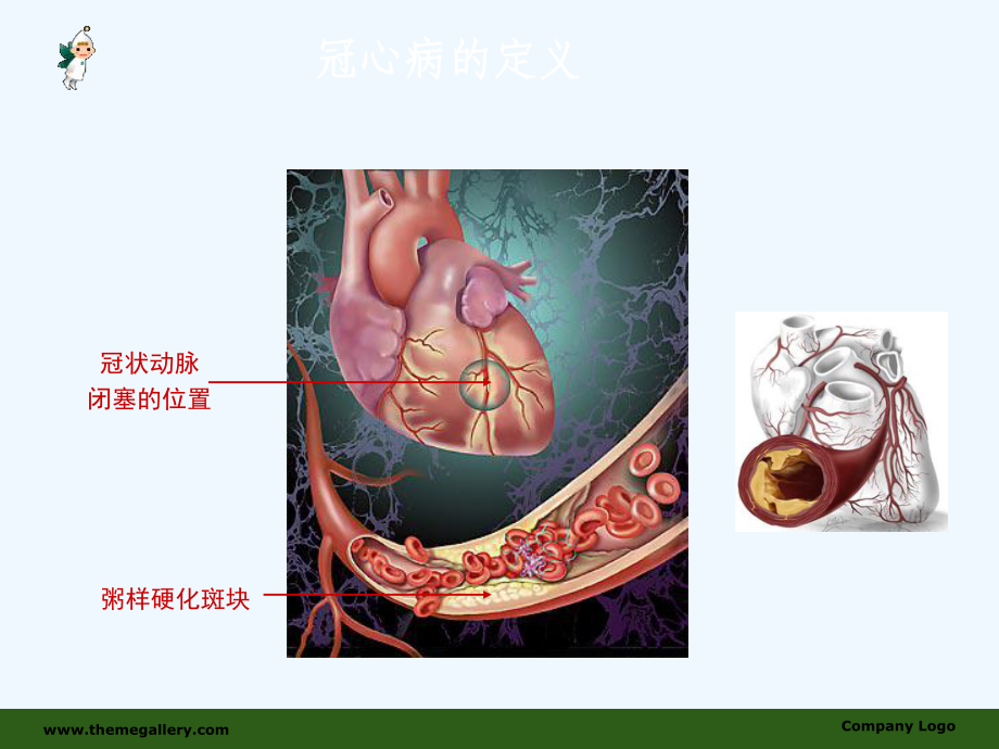 冠心病的诊断与治疗权威之作课件.ppt_第3页