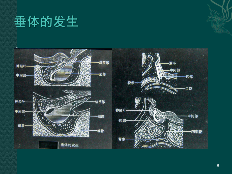 垂体病变的影像学诊断课件.ppt_第3页