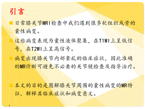 医学课件膝关节囊性病变的MRI诊断.ppt