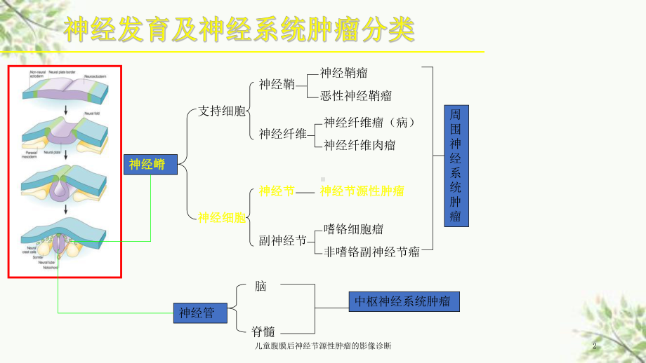 儿童腹膜后神经节源性肿瘤的影像诊断课件.ppt_第2页