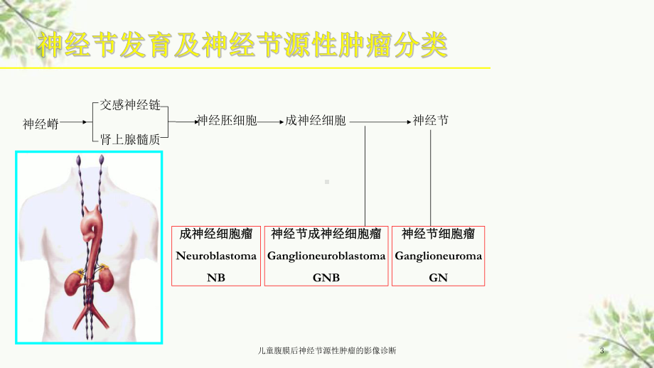 儿童腹膜后神经节源性肿瘤的影像诊断课件.ppt_第3页