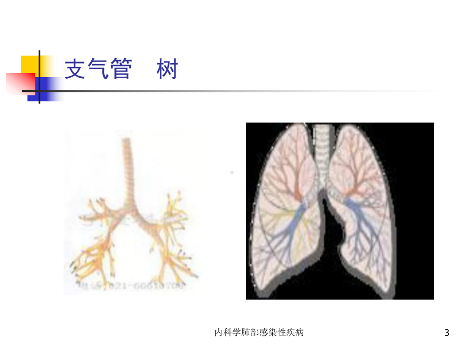 内科学肺部感染性疾病课件.ppt_第3页