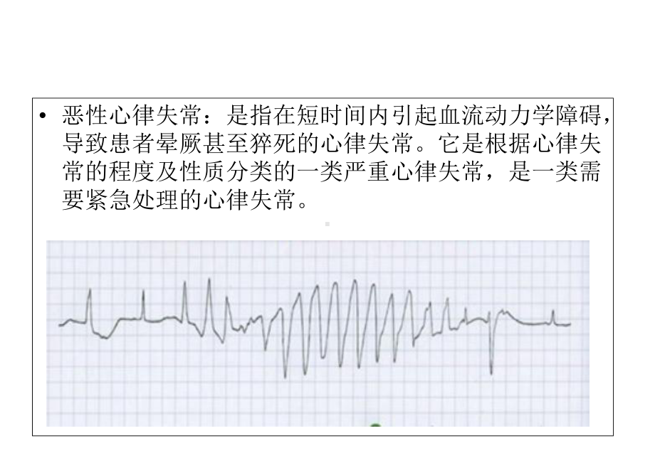 医学围术期恶性心律失常的识别及处理专题培训课件.ppt_第3页