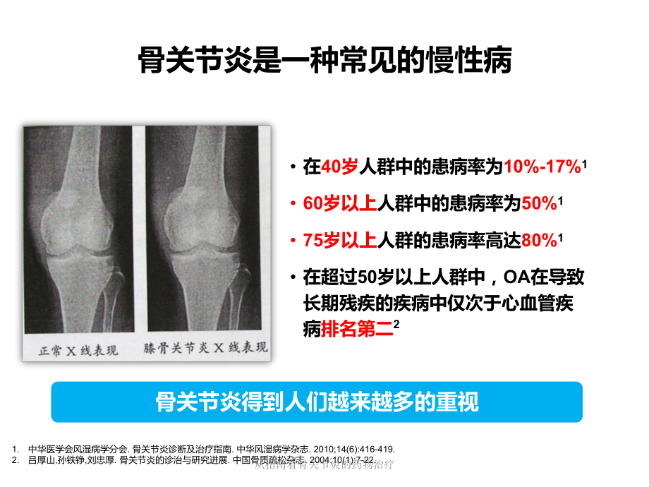 从指南看骨关节炎的药物治疗课件.pptx_第2页