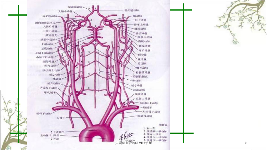 头颈部血管的CTAMRA诊断课件.ppt_第2页