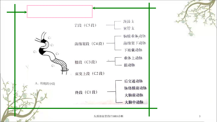 头颈部血管的CTAMRA诊断课件.ppt_第3页