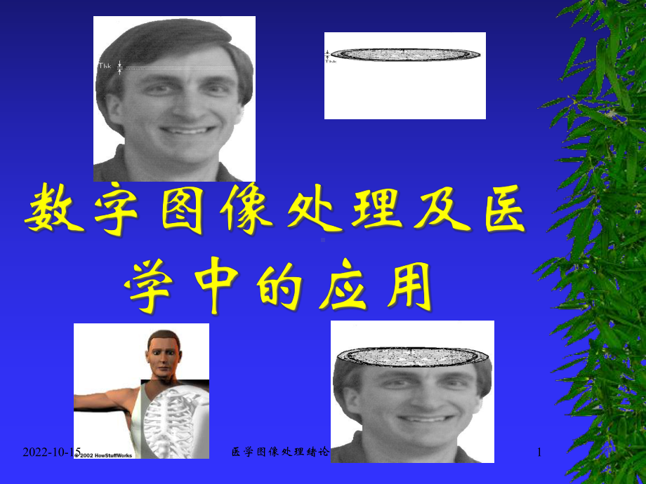 医学图像处理绪论课件.ppt_第1页