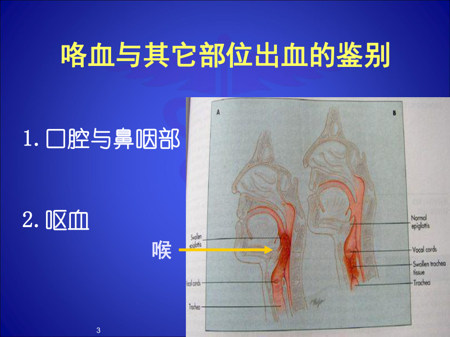 咯血诊断学精选课件.ppt_第3页