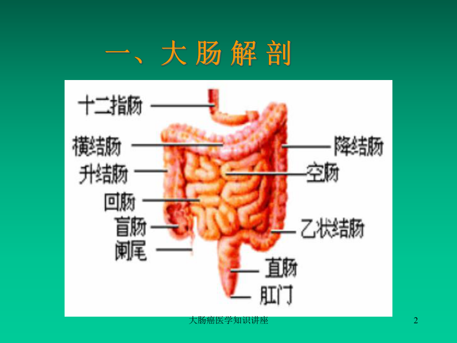 大肠癌医学知识讲座培训课件.ppt_第2页