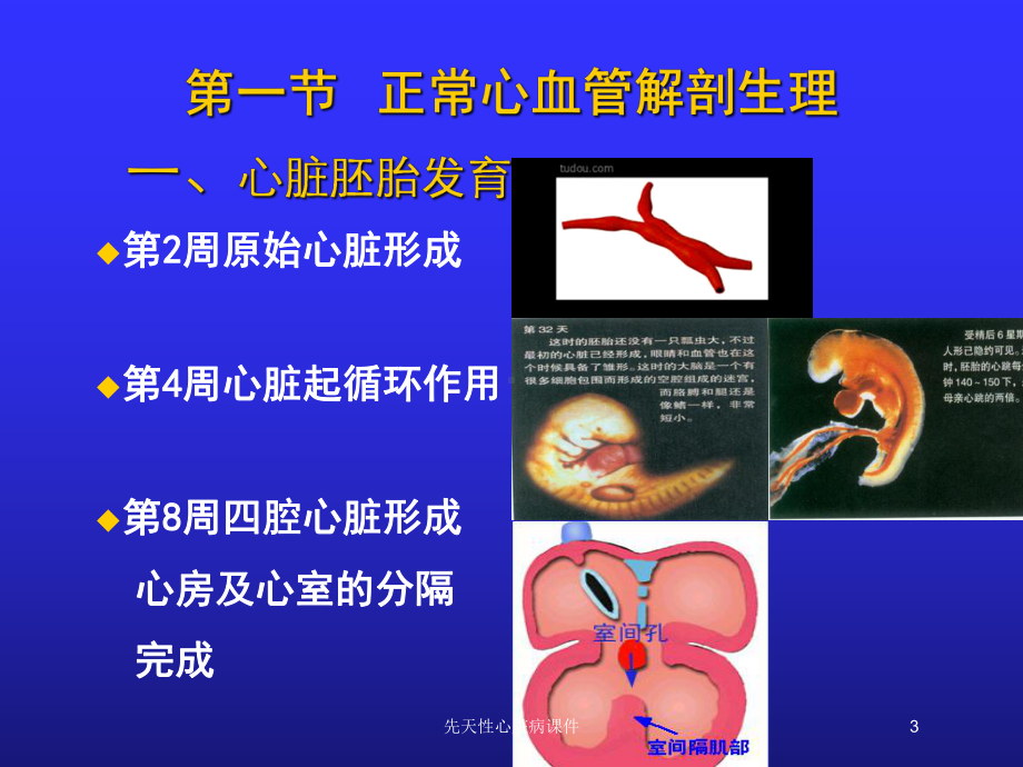 先天性心脏病课件培训课件.ppt_第3页