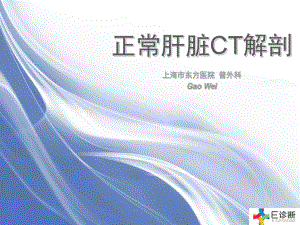 医学影像-正常肝脏CT解剖课件.ppt