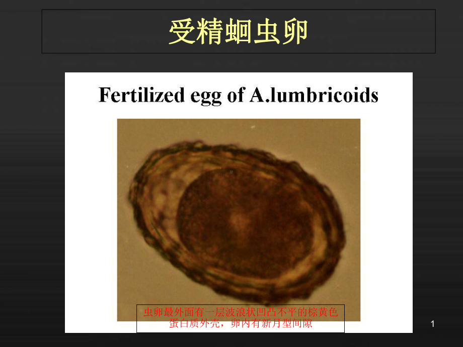 寄生虫标本考试图谱课件.ppt_第1页