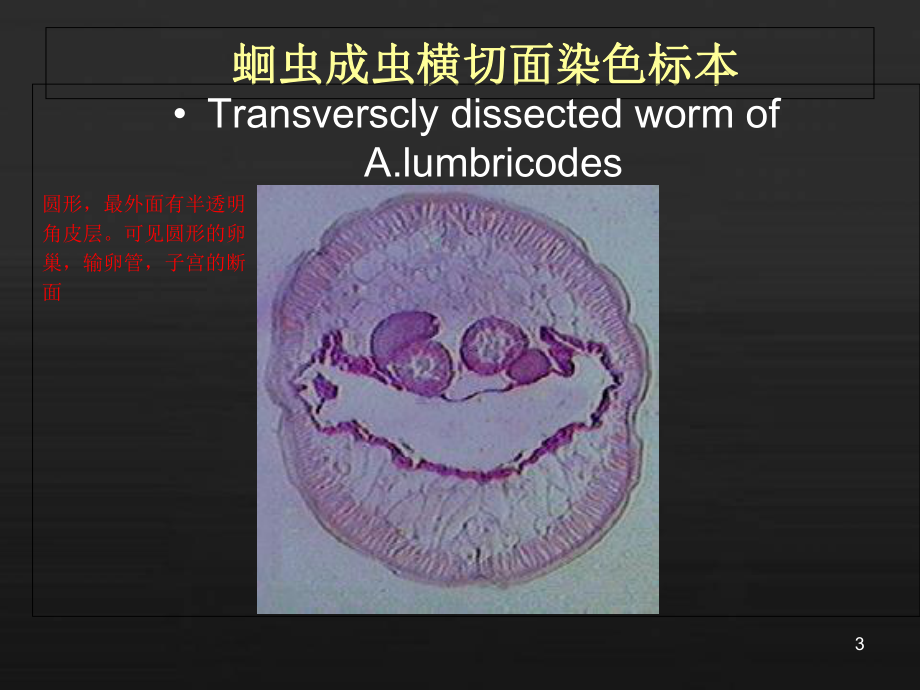 寄生虫标本考试图谱课件.ppt_第3页