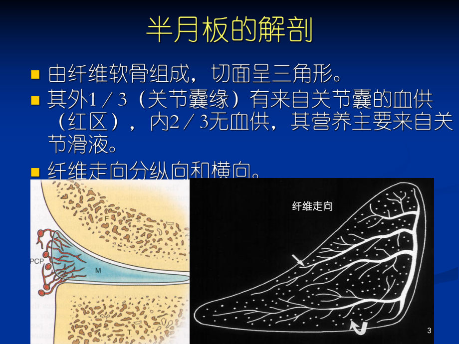 半月板撕裂的MR诊断医学课件.ppt_第3页